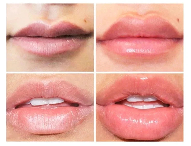 Hidra Lips  - Sérum labial com vitamina E